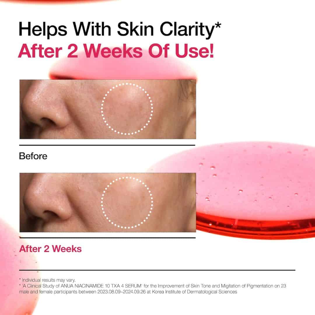ANUA Niacinamide 10% + TXA 4% Dark Spot Correcting Serum