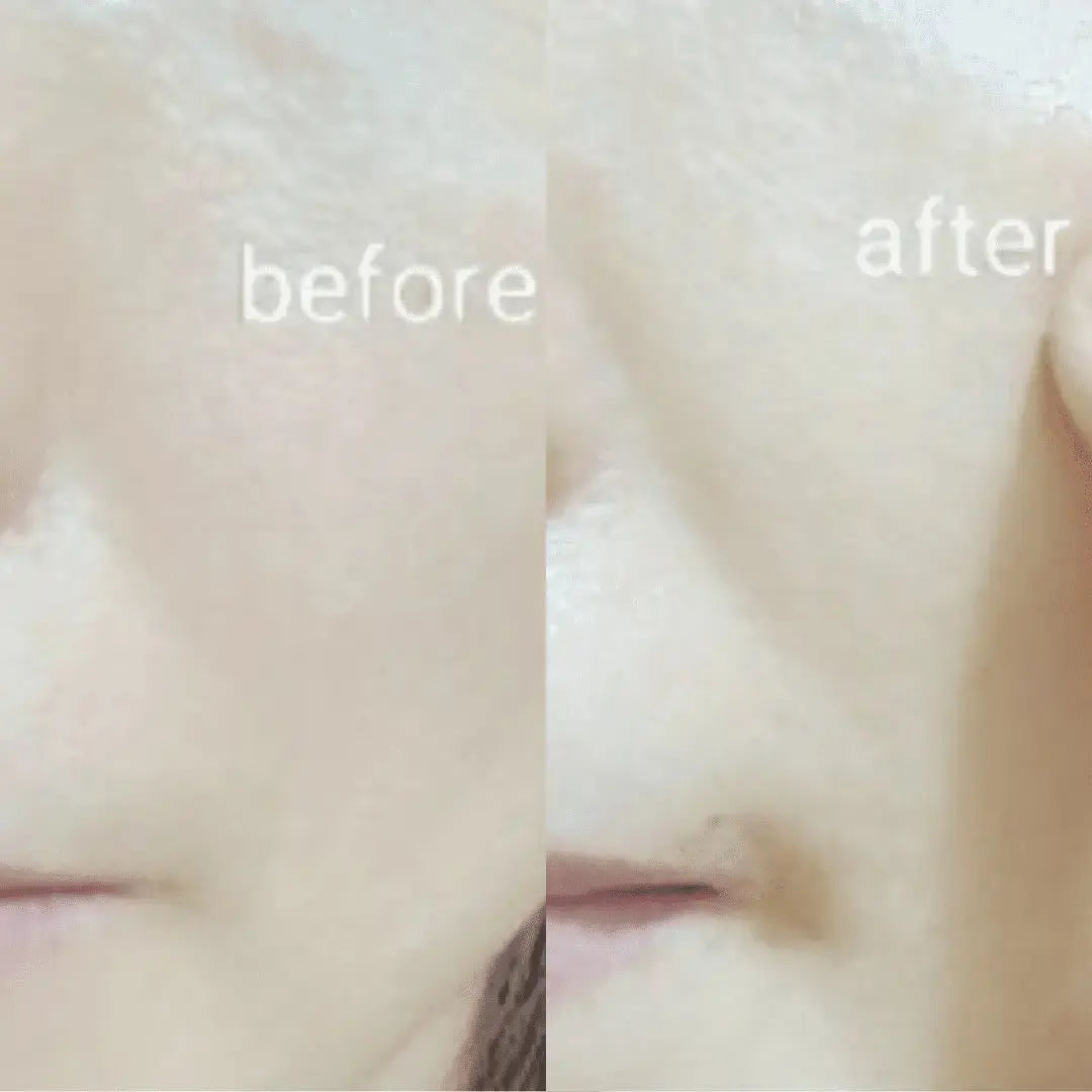 Ja Yeon Mapping Collagen Anti-Aging Mask - 5 Units