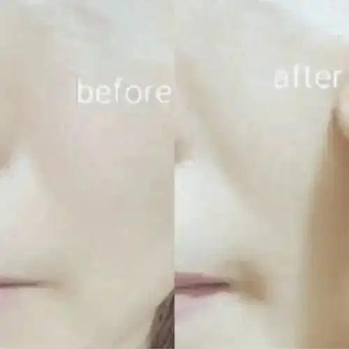Ja Yeon Mapping Essence Mask Bundle