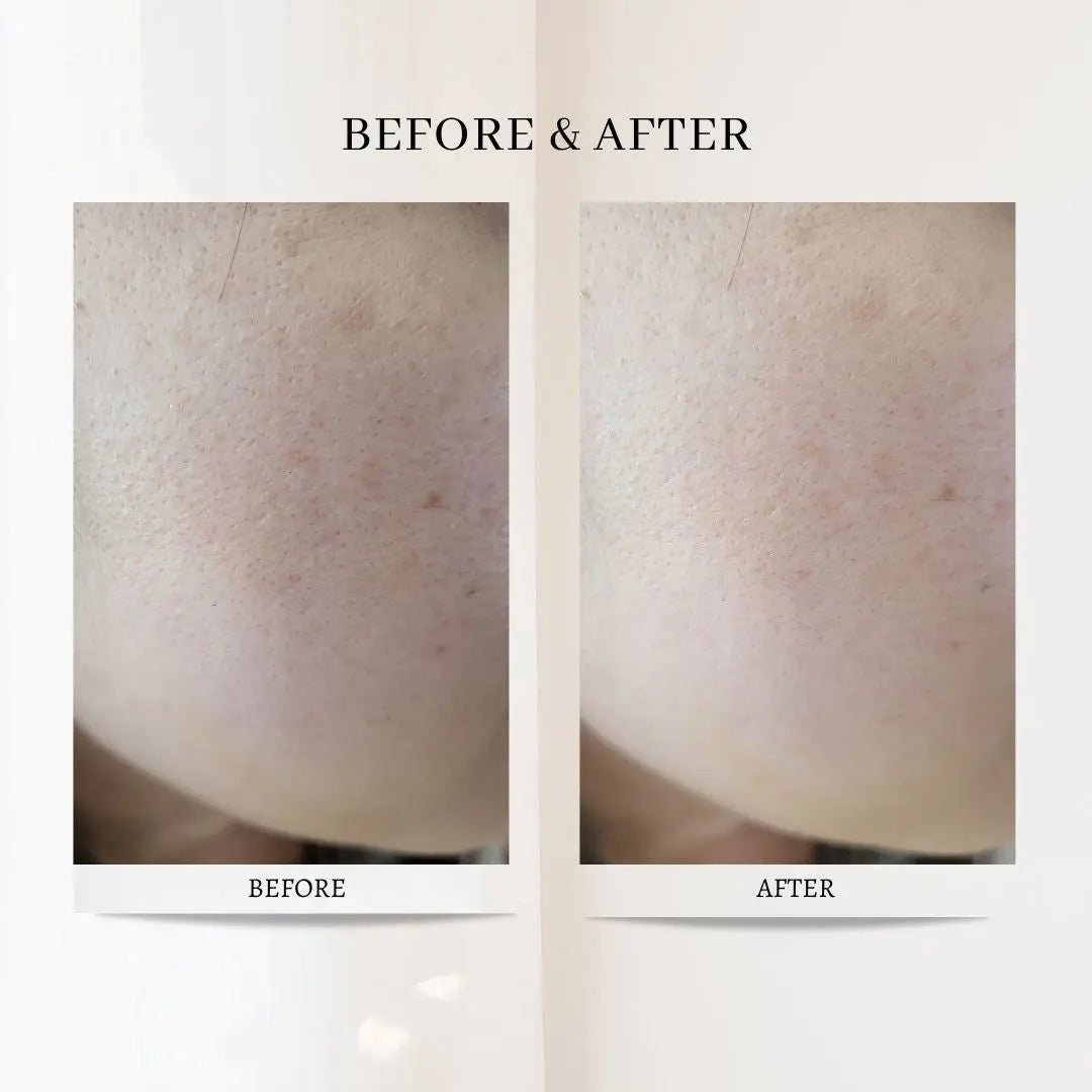 (3 Units) Retinol Collagen Boosting Serum