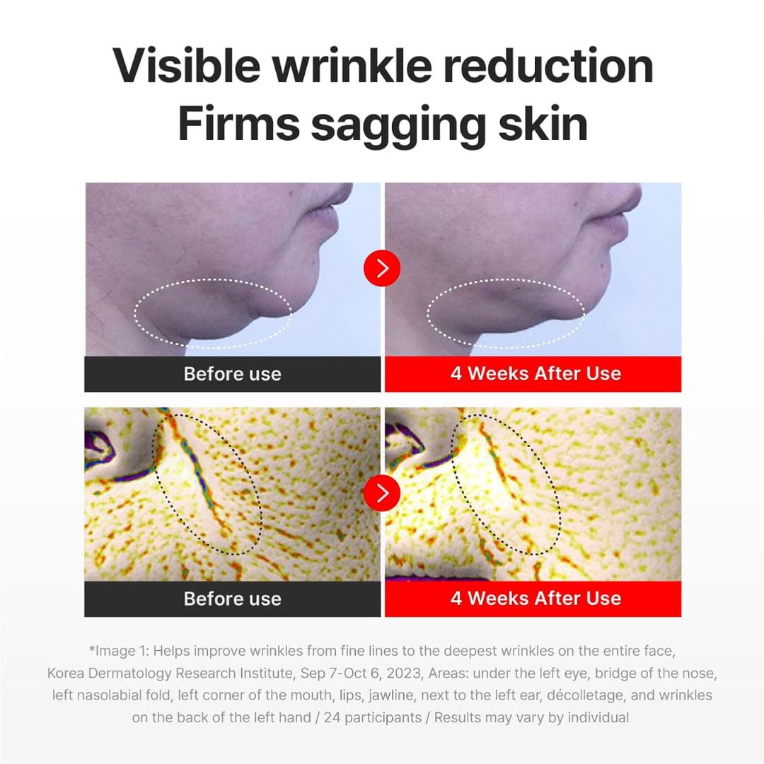 Centellian24 Madeca Cream Time Reverse