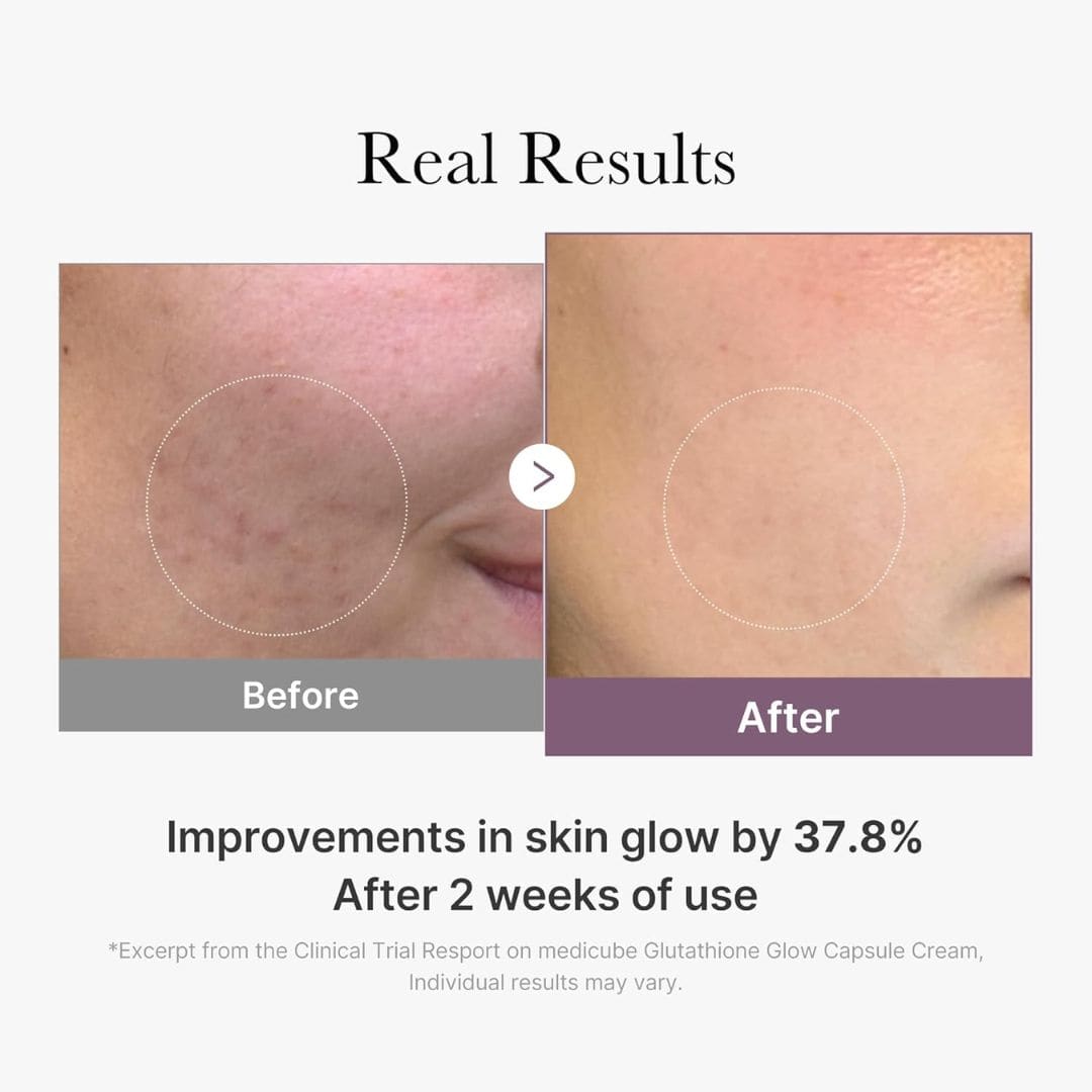 (3 Units) AGE-R Glutathione Glow Capsule Cream