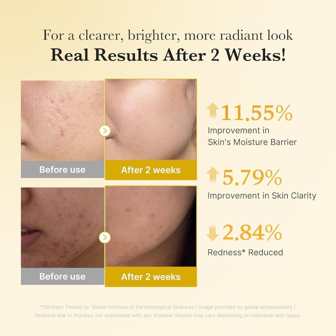 Medicube Kojic Acid Turmeric Niacinamide Serum