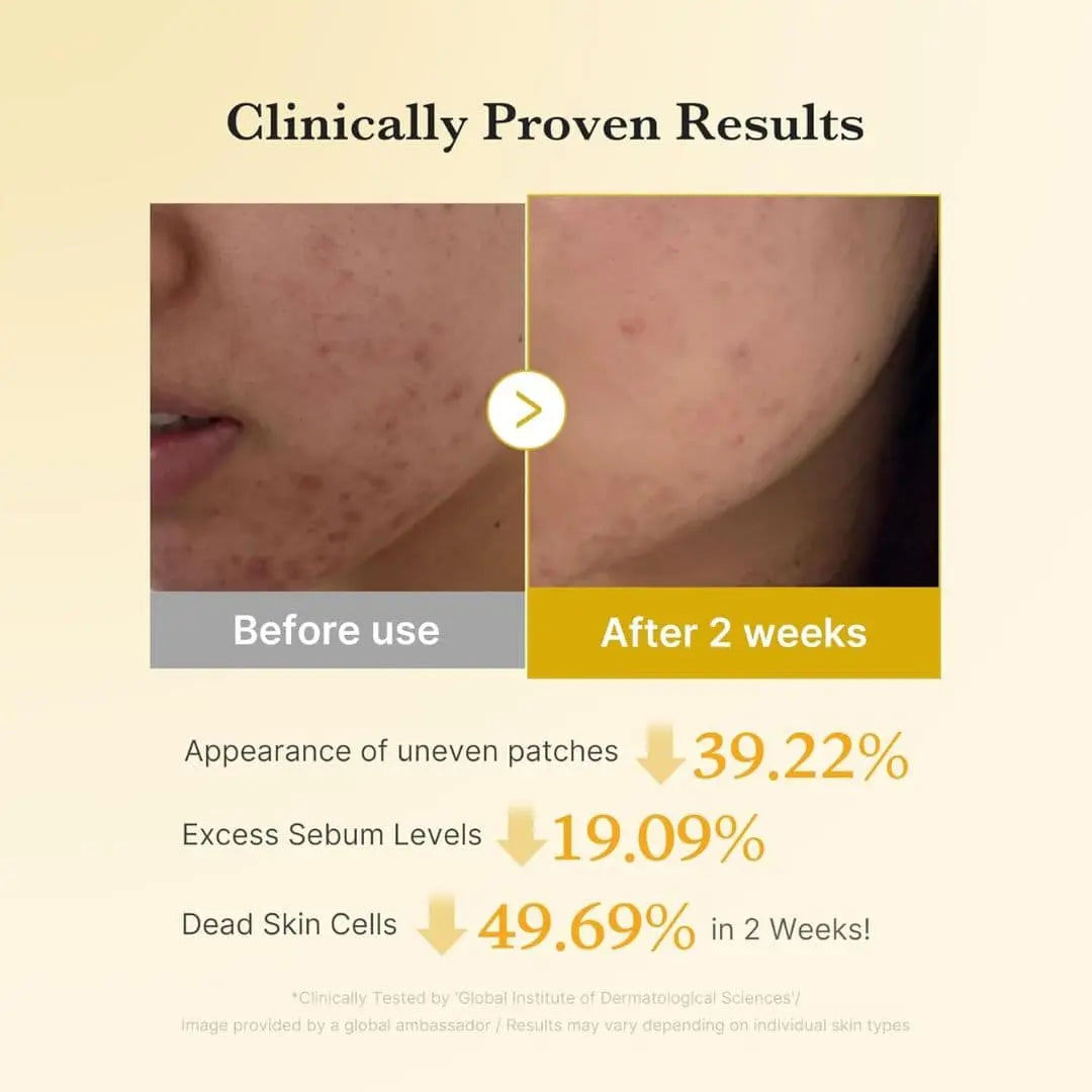 (3 Units) Kojic Acid Turmeric Pad 70pads