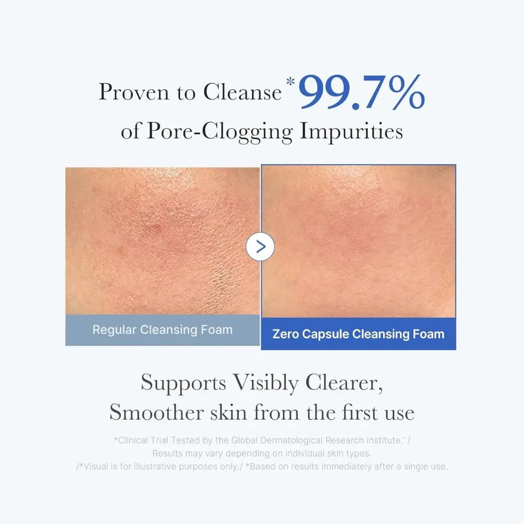 (3 Units) Zero Pore Clearing Capsule Cleansing Foam