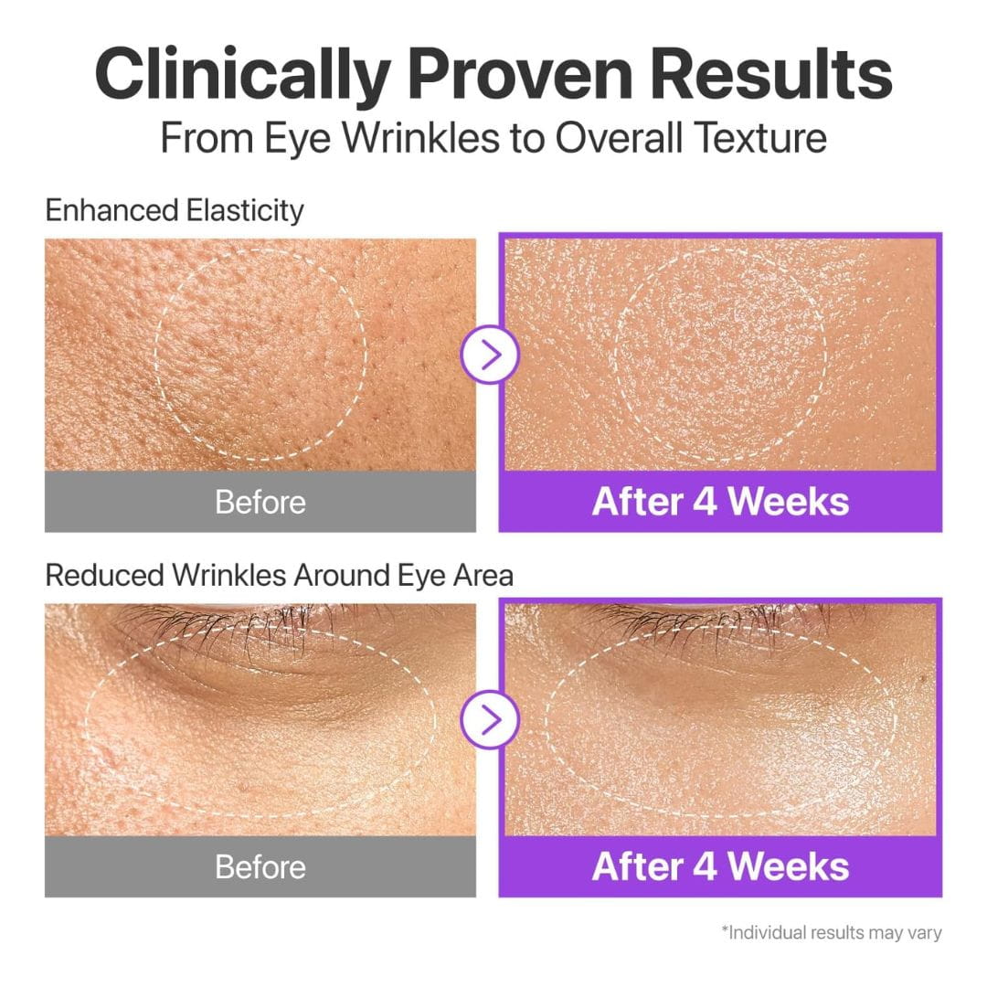 (3 Units) No.9 NAD Bio Lifting-Sil Essence Numbuzin